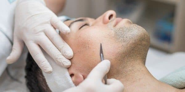 Dermaplaning