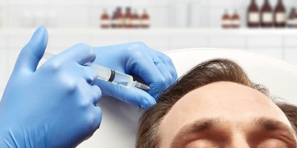 Mesoterapia Capilar