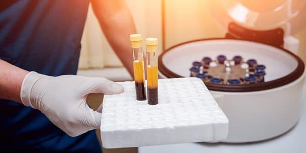 Plasma Rico en Plaquetas (PRP)